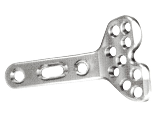 Distal Radius Metacarpal Side Column Locking Plates