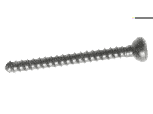 4.5mm Cortical Screws