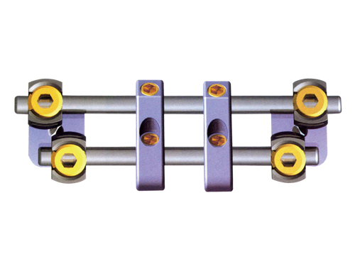 Anterior Thoracic/Lumbar Vertebra Screw & Rod System