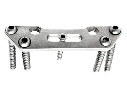 Anterior Cervical Spine Titanium Plate